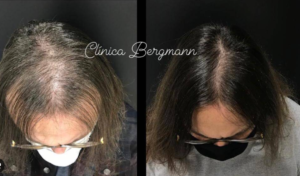 Aplicativos Para Crescimento do Cabelo