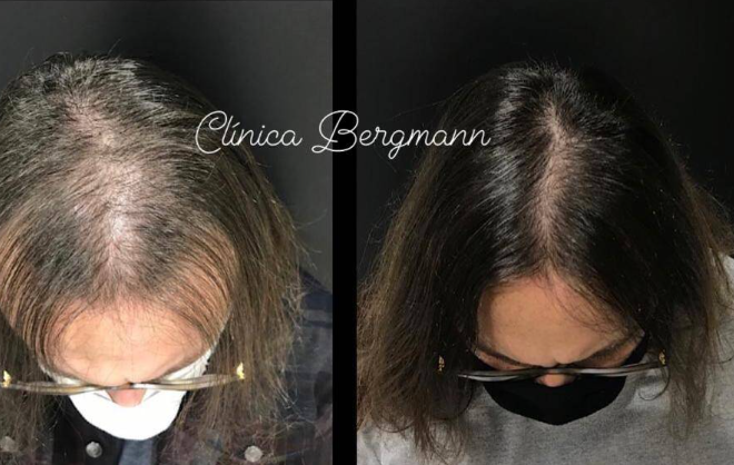 Aplicativos Para Crescimento do Cabelo