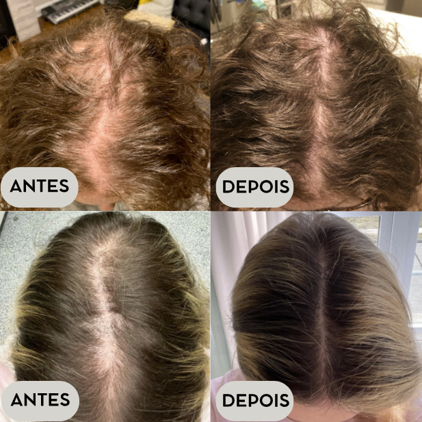 Aplicativos para Estimular o Crescimento Capilar